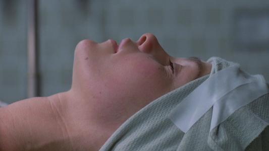 Coma